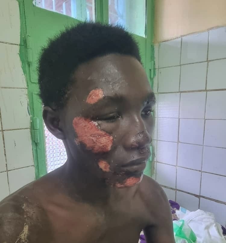 Tchad : un père interpelle les autorités après l&rsquo;agression près du camp 27